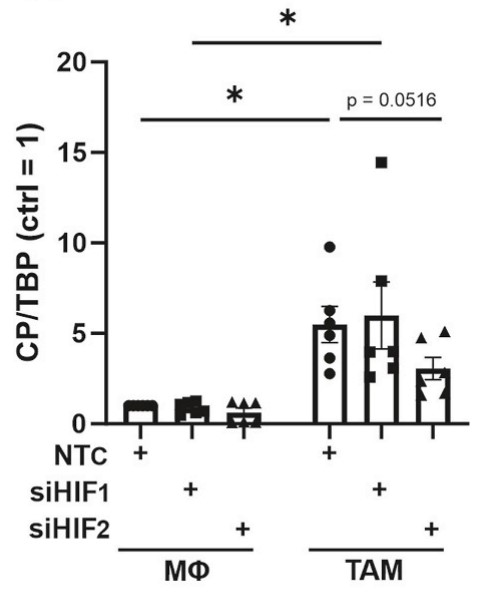 Ceruloplasmin (CP) mRNA was measured and normalized to TATA box binding protein (TBP).jpg